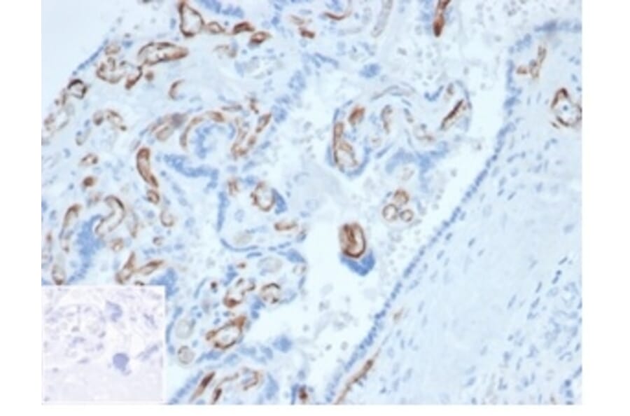 Immunohistochemistry - Anti-FABP4 Antibody [FABP4/4423] (A277587) - Antibodies.com
