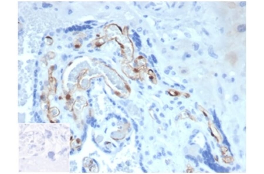 Immunohistochemistry - Anti-FABP4 Antibody [FABP4/4424] (A277588) - Antibodies.com