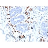 Immunohistochemistry - Anti-FABP4 Antibody [FABP4/4426] (A277589) - Antibodies.com