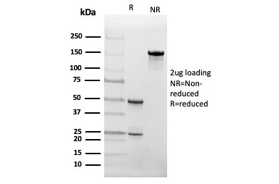 SDS-PAGE - Anti-FABP4 Antibody [FABP4/4426] (A277589) - Antibodies.com