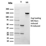SDS-PAGE - Anti-FABP4 Antibody [FABP4/4426] (A277589) - Antibodies.com