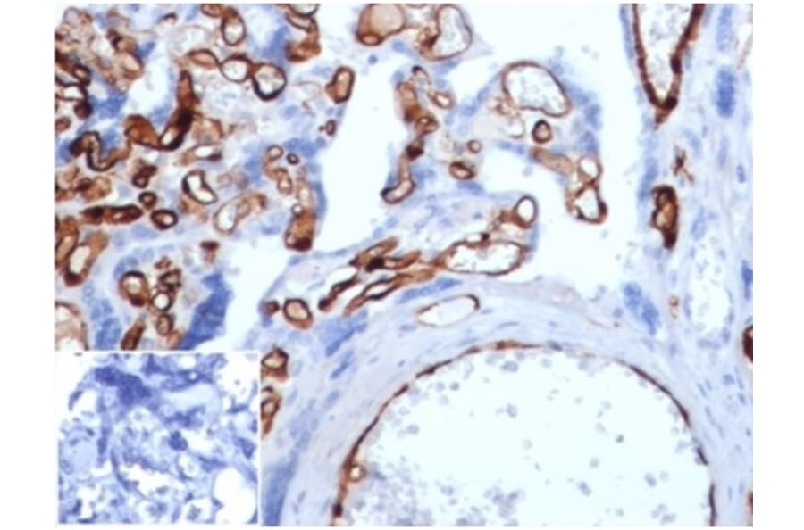 Immunohistochemistry - Anti-FABP4 Antibody [FABP4/4429] (A277590) - Antibodies.com