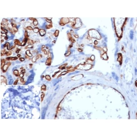 Immunohistochemistry - Anti-FABP4 Antibody [FABP4/4429] (A277590) - Antibodies.com
