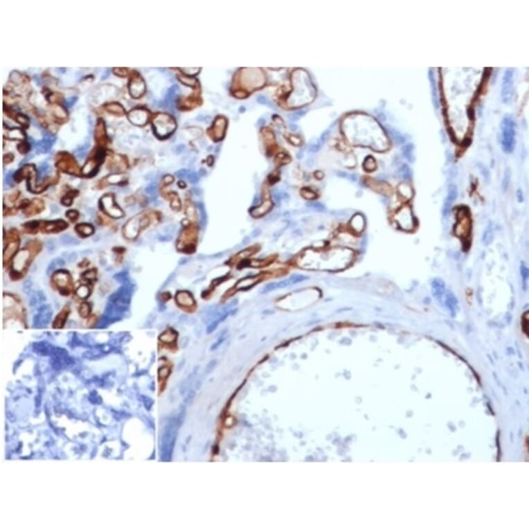 Immunohistochemistry - Anti-FABP4 Antibody [FABP4/4429] (A277590) - Antibodies.com