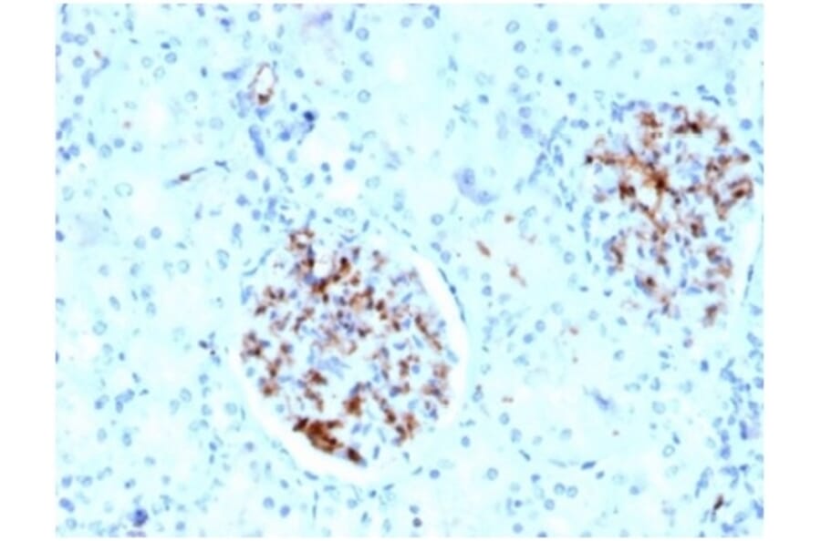 Immunohistochemistry - Anti-FABP4 Antibody [FABP4/4429] (A277590) - Antibodies.com