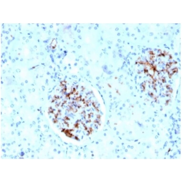 Immunohistochemistry - Anti-FABP4 Antibody [FABP4/4429] (A277590) - Antibodies.com