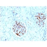 Immunohistochemistry - Anti-FABP4 Antibody [FABP4/4429] (A277590) - Antibodies.com