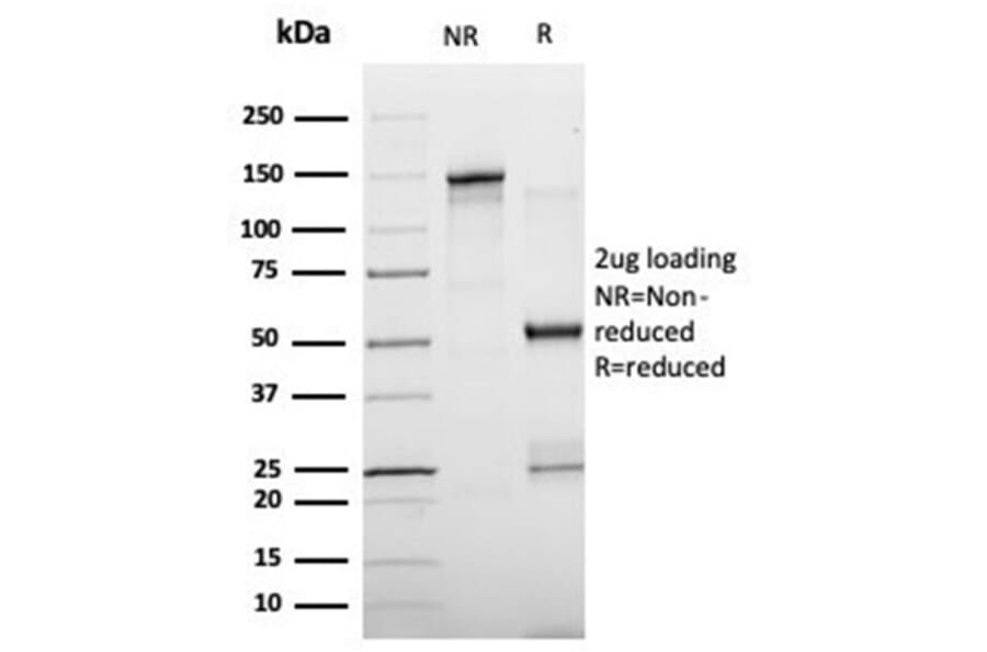 SDS-PAGE - Anti-FABP4 Antibody [FABP4/4429] (A277590) - Antibodies.com