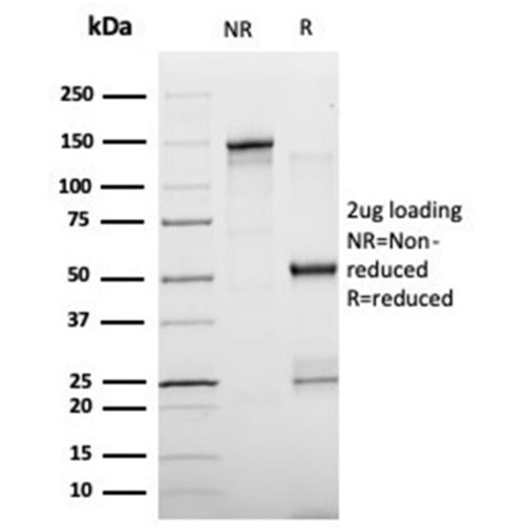 SDS-PAGE - Anti-FABP4 Antibody [FABP4/4429] (A277590) - Antibodies.com