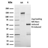 SDS-PAGE - Anti-FABP4 Antibody [FABP4/4429] (A277590) - Antibodies.com