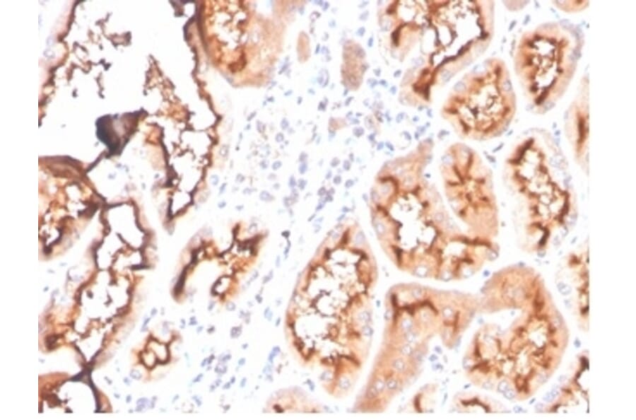 Immunohistochemistry - Anti-FABP1 Antibody [FABP1/3940] (A277591) - Antibodies.com