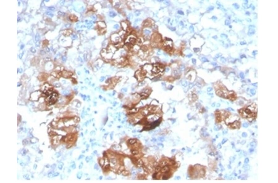 Immunohistochemistry - Anti-FABP1 Antibody [FABP1/3940] (A277591) - Antibodies.com