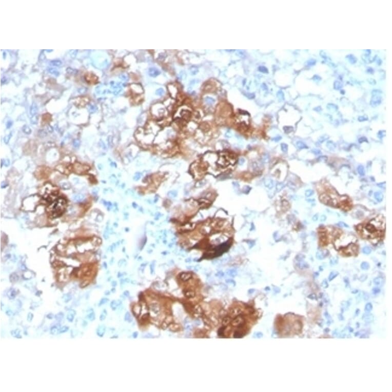 Immunohistochemistry - Anti-FABP1 Antibody [FABP1/3940] (A277591) - Antibodies.com