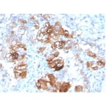 Immunohistochemistry - Anti-FABP1 Antibody [FABP1/3940] (A277591) - Antibodies.com