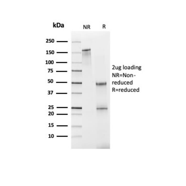 SDS-PAGE - Anti-FABP1 Antibody [FABP1/3940] (A277591) - Antibodies.com