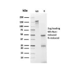 SDS-PAGE - Anti-FABP1 Antibody [FABP1/3940] (A277591) - Antibodies.com