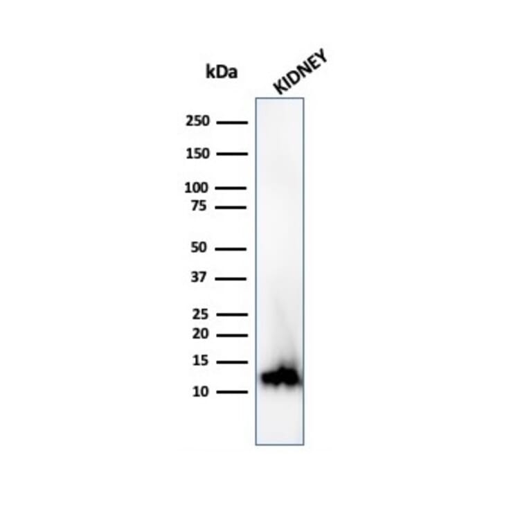 Western Blot - Anti-FABP1 Antibody [FABP1/3940] (A277591) - Antibodies.com