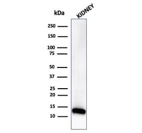 Western Blot - Anti-FABP1 Antibody [FABP1/3485] (A277592) - Antibodies.com