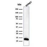 Western Blot - Anti-FABP1 Antibody [FABP1/3485] (A277592) - Antibodies.com