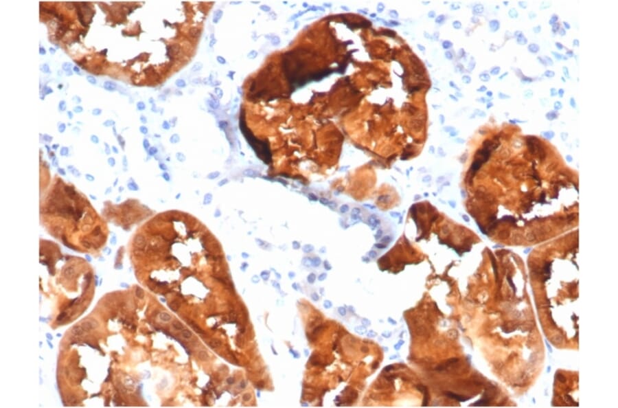 Immunohistochemistry - Anti-FABP1 Antibody [FABP1/3485] (A277592) - Antibodies.com