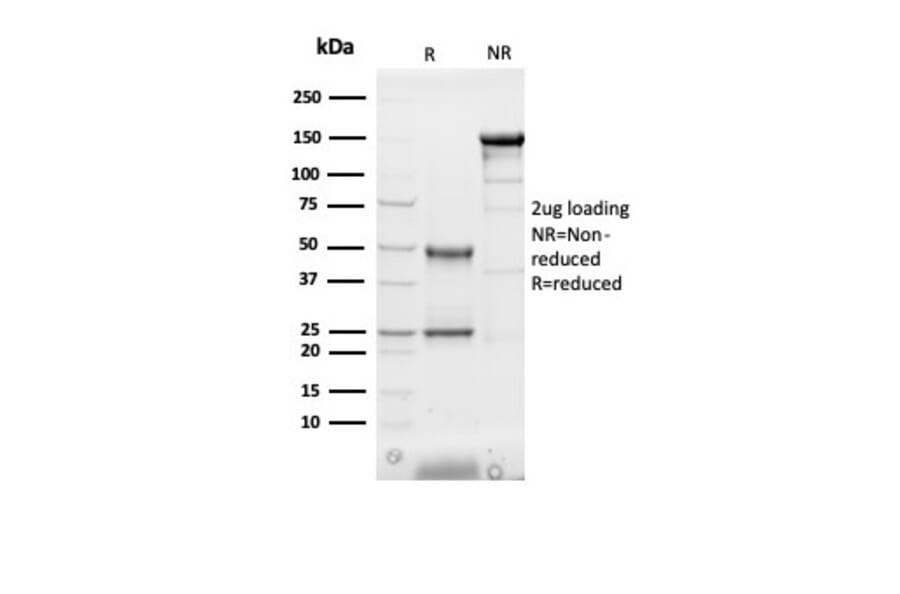 SDS-PAGE - Anti-H-FABP Antibody [FABP3/3430] (A277593) - Antibodies.com
