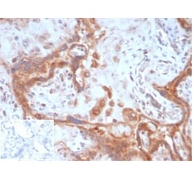 Immunohistochemistry - Anti-Fibroblast Activation Protein alpha Antibody [FAP/4851] (A277594) - Antibodies.com