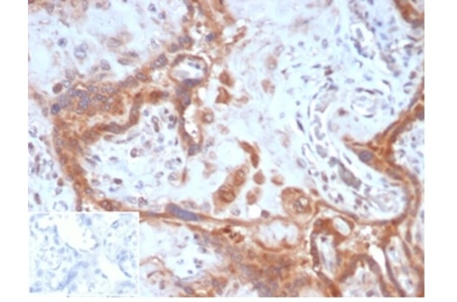 Immunohistochemistry - Anti-Fibroblast Activation Protein alpha Antibody [FAP/4851] (A277594) - Antibodies.com