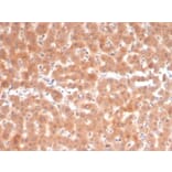 Immunohistochemistry - Anti-Fibroblast Activation Protein alpha Antibody [FAP/4853] (A277595) - Antibodies.com