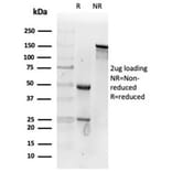 SDS-PAGE - Anti-Fibroblast Activation Protein alpha Antibody [FAP/4853] (A277595) - Antibodies.com