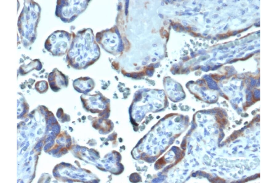 Immunohistochemistry - Anti-Fibroblast Activation Protein alpha Antibody [FAP/4854] (A277596) - Antibodies.com