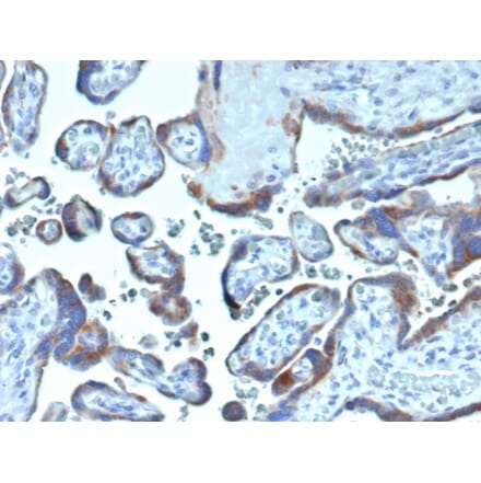 Immunohistochemistry - Anti-Fibroblast Activation Protein alpha Antibody [FAP/4854] (A277596) - Antibodies.com