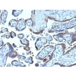 Immunohistochemistry - Anti-Fibroblast Activation Protein alpha Antibody [FAP/4854] (A277596) - Antibodies.com