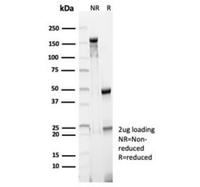 SDS-PAGE - Anti-CD23 Antibody [FCER2/6890] (A277597) - Antibodies.com