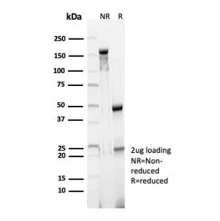 SDS-PAGE - Anti-CD23 Antibody [FCER2/6890] (A277597) - Antibodies.com