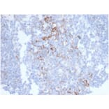 Immunohistochemistry - Anti-CD23 Antibody [FCER2/6890] (A277597) - Antibodies.com