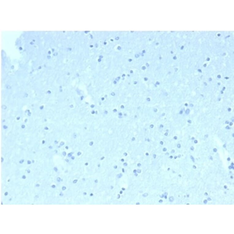 Immunohistochemistry - Anti-CD23 Antibody [FCER2/6890] (A277597) - Antibodies.com