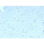 Immunohistochemistry - Anti-CD23 Antibody [FCER2/6890] (A277597) - Antibodies.com
