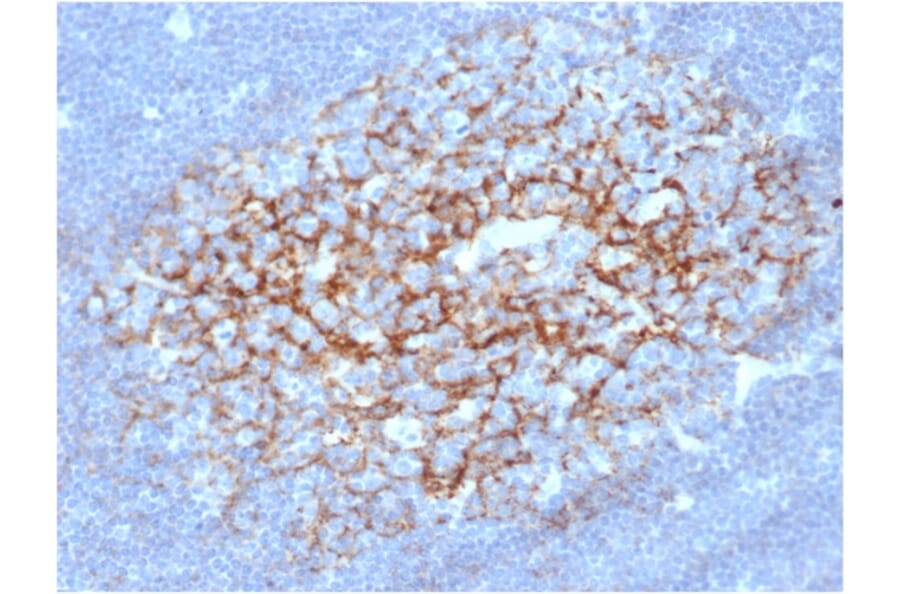 Immunohistochemistry - Anti-CD23 Antibody [FCER2/6891] (A277598) - Antibodies.com