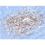 Immunohistochemistry - Anti-CD23 Antibody [FCER2/6891] (A277598) - Antibodies.com