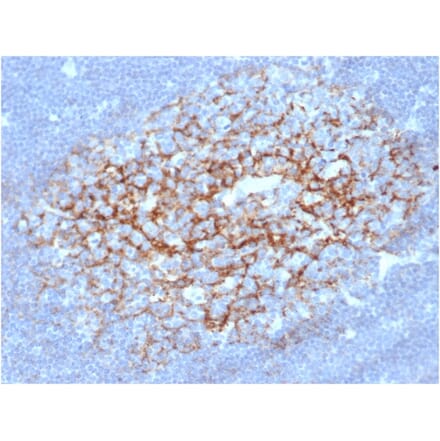 Immunohistochemistry - Anti-CD23 Antibody [FCER2/6892] (A277599) - Antibodies.com