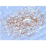 Immunohistochemistry - Anti-CD23 Antibody [FCER2/6892] (A277599) - Antibodies.com