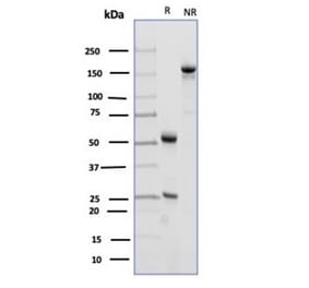 SDS-PAGE - Anti-CD23 Antibody [FCER2/4918] (A277600) - Antibodies.com