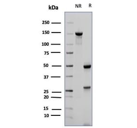 SDS-PAGE - Anti-CD23 Antibody [FCER2/6887] (A277601) - Antibodies.com