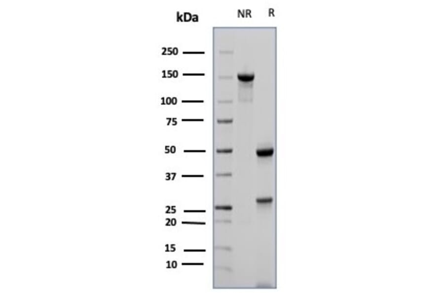 SDS-PAGE - Anti-CD23 Antibody [FCER2/6887] (A277601) - Antibodies.com