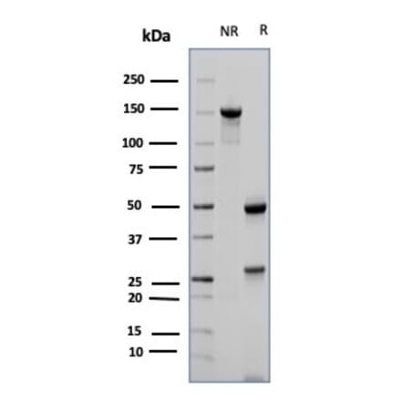 SDS-PAGE - Anti-CD23 Antibody [FCER2/6887] (A277601) - Antibodies.com
