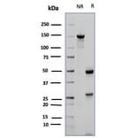 SDS-PAGE - Anti-CD23 Antibody [FCER2/6887] (A277601) - Antibodies.com