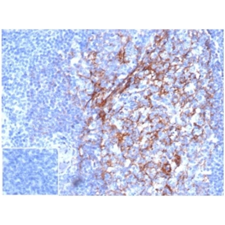 Immunohistochemistry - Anti-CD23 Antibody [FCER2/6887] (A277601) - Antibodies.com