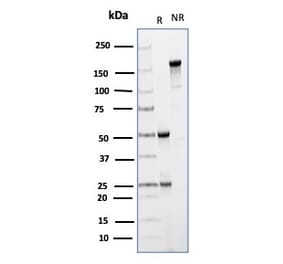SDS-PAGE - Anti-CD64 Antibody [FCGR1A/4950] (A277602) - Antibodies.com