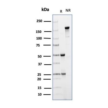 SDS-PAGE - Anti-CD64 Antibody [FCGR1A/4950] (A277602) - Antibodies.com
