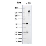 SDS-PAGE - Anti-CD64 Antibody [FCGR1A/4950] (A277602) - Antibodies.com